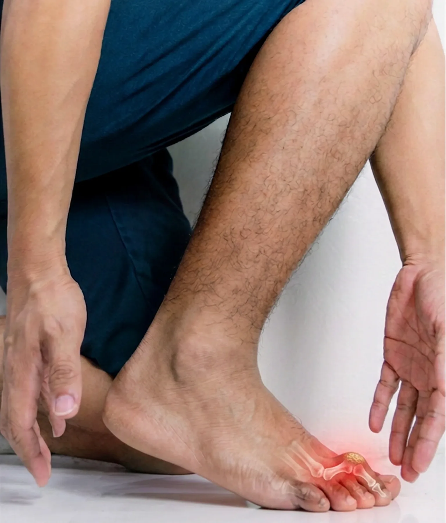 Lesser toes buckled into a bent hammer-toe position
